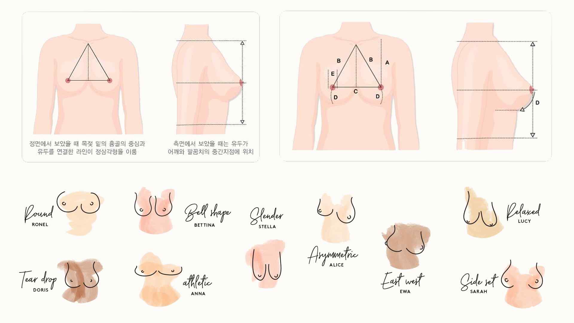 桃園隆乳手術,隆乳胸型,自我胸型檢測