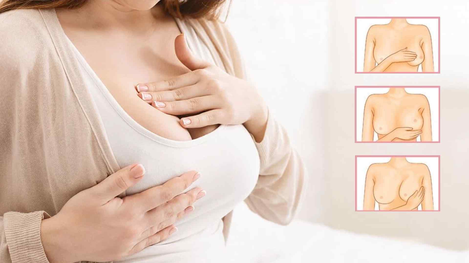 隆乳後按摩,隆乳術後保養,桃園隆乳醫美