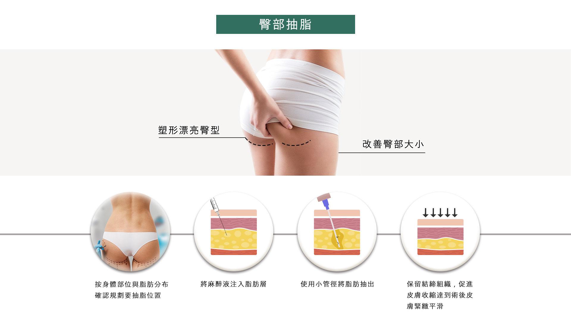 桃園抽脂手術_永恆醫美