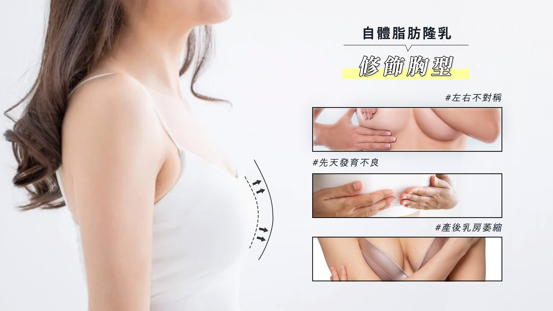 桃園自體脂肪補臉豐頰價格費用權威醫師推薦005