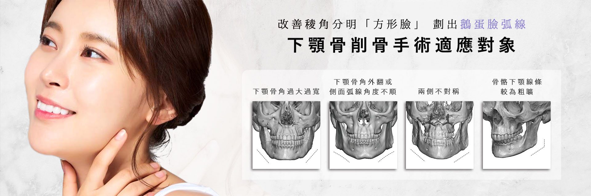 台南桃園削骨手術,台南桃園顴骨內推,台南桃園下顎骨角削骨,台南桃園下巴截骨