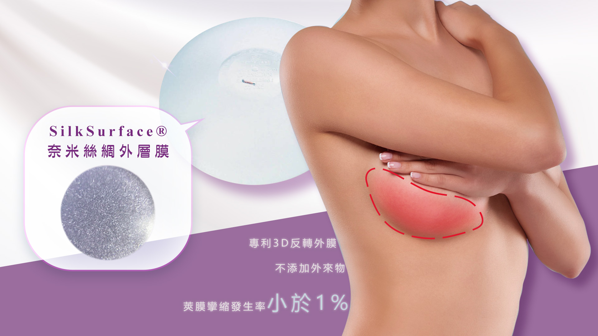 桃園Motiva魔滴2.0隆乳手術權威醫師推薦價格費用003