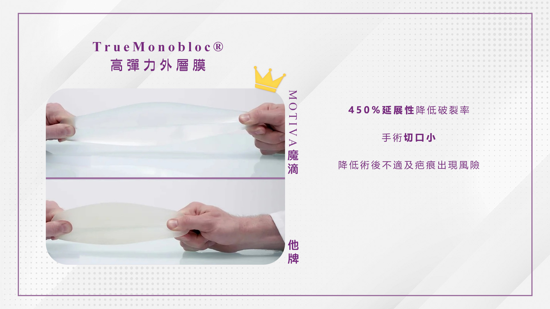 桃園Motiva魔滴2.0隆乳手術權威醫師推薦價格費用005