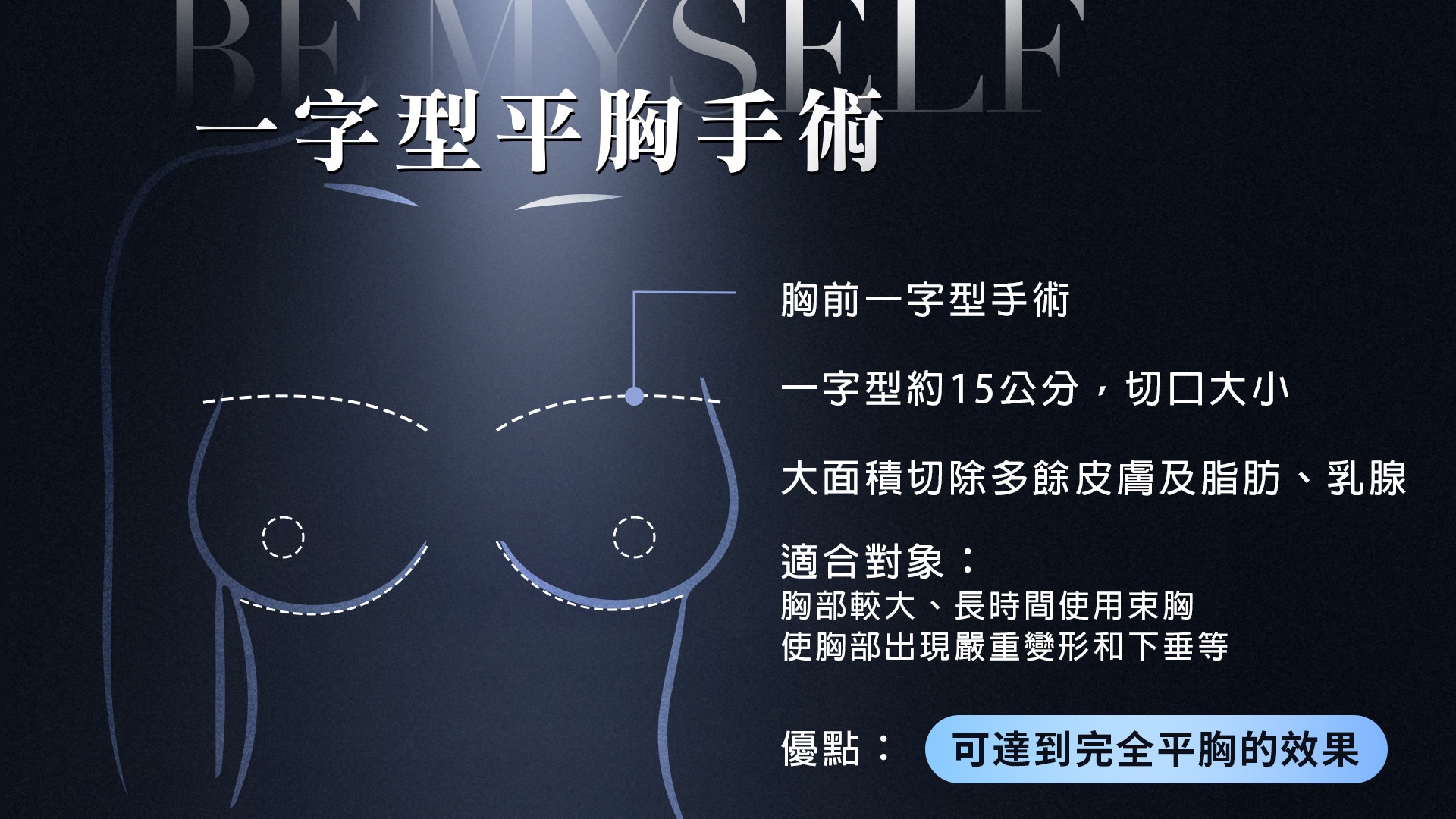 桃園平胸縮胸切乳手術權威醫師推薦005