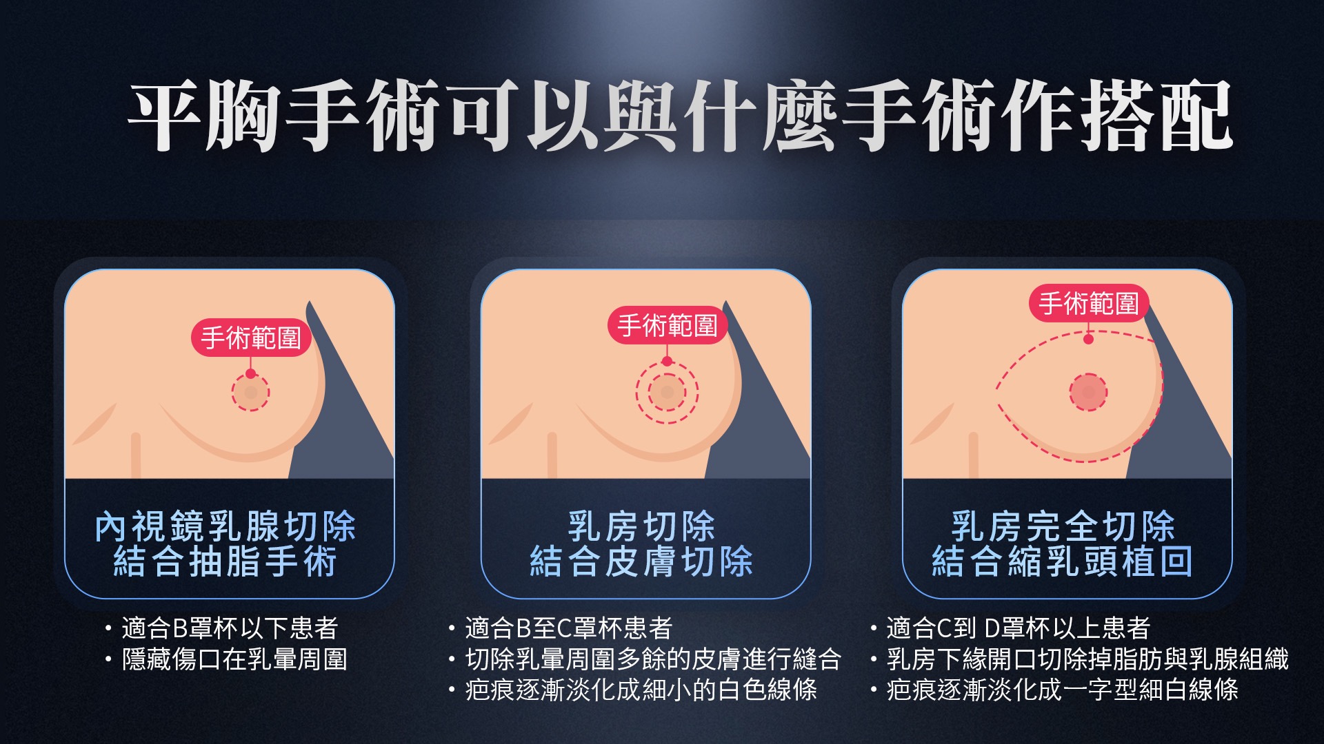 桃園平胸縮胸切乳手術權威醫師推薦006