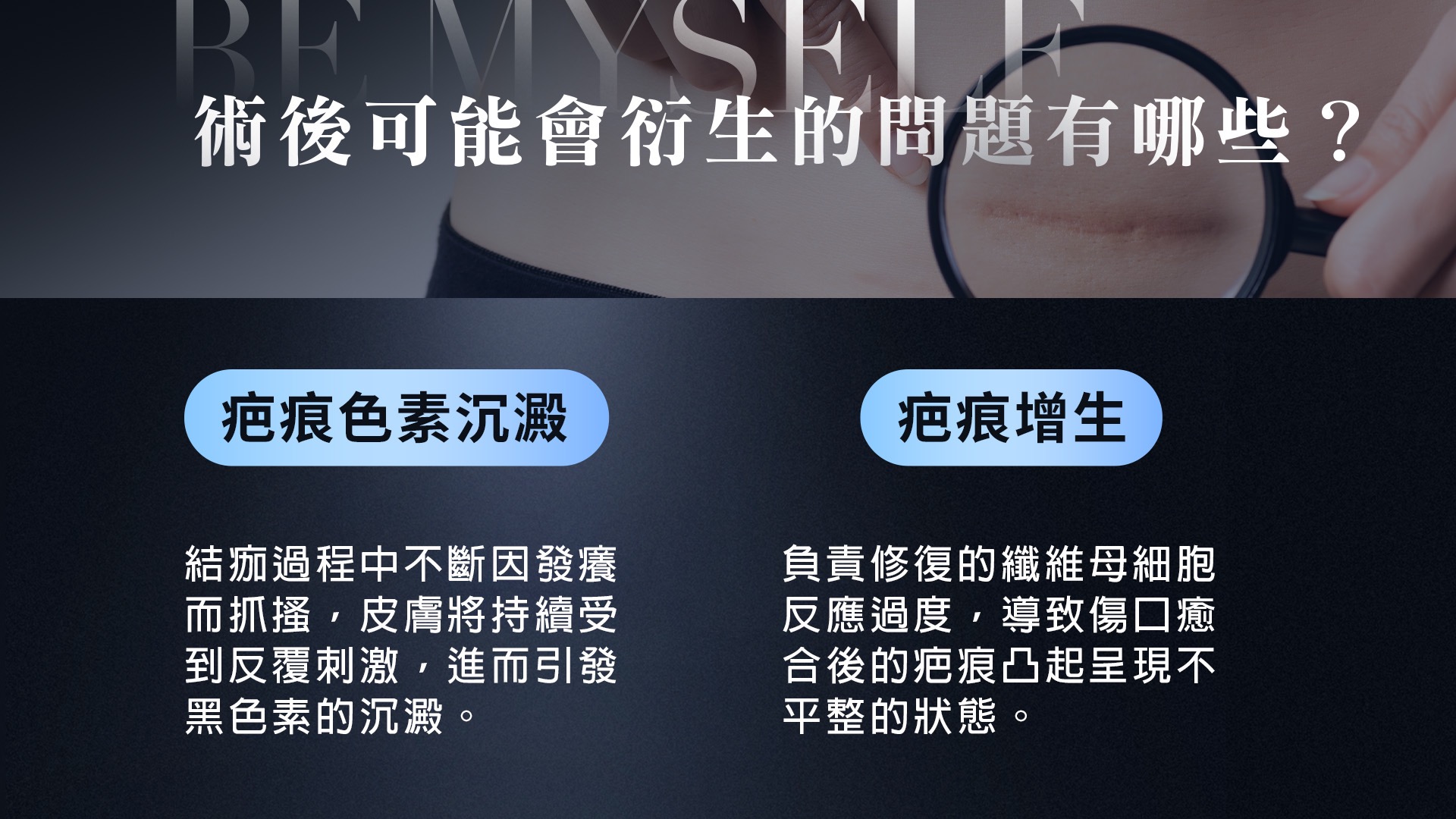 桃園平胸縮胸切乳手術權威醫師推薦008