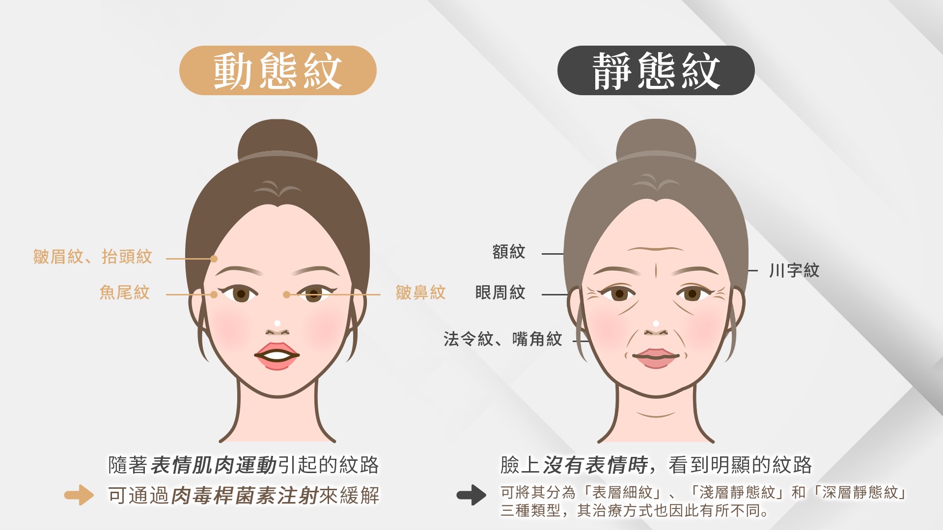 桃園天鵝頸手術權威醫師推薦007