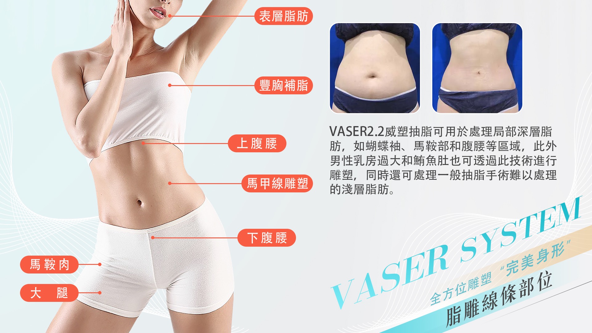 桃園Vaser2.2威塑抽脂004
