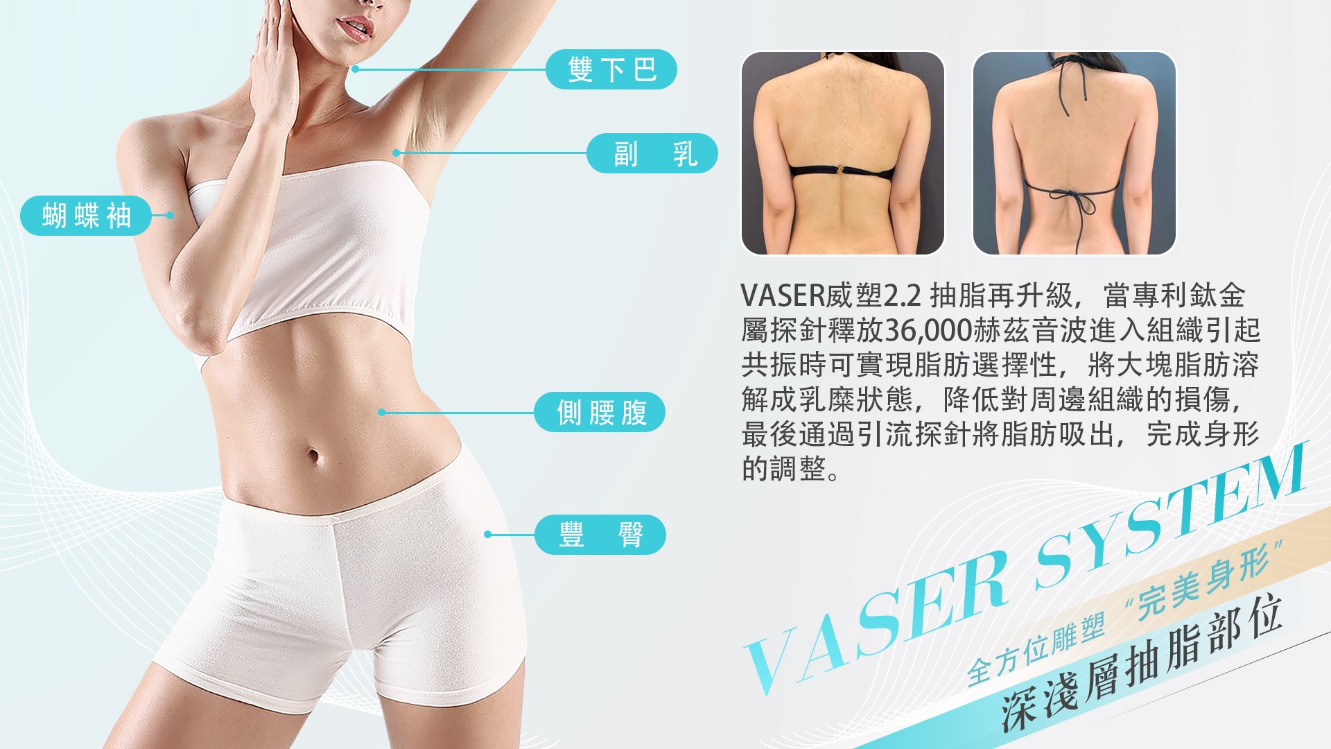 桃園Vaser2.2威塑抽脂008