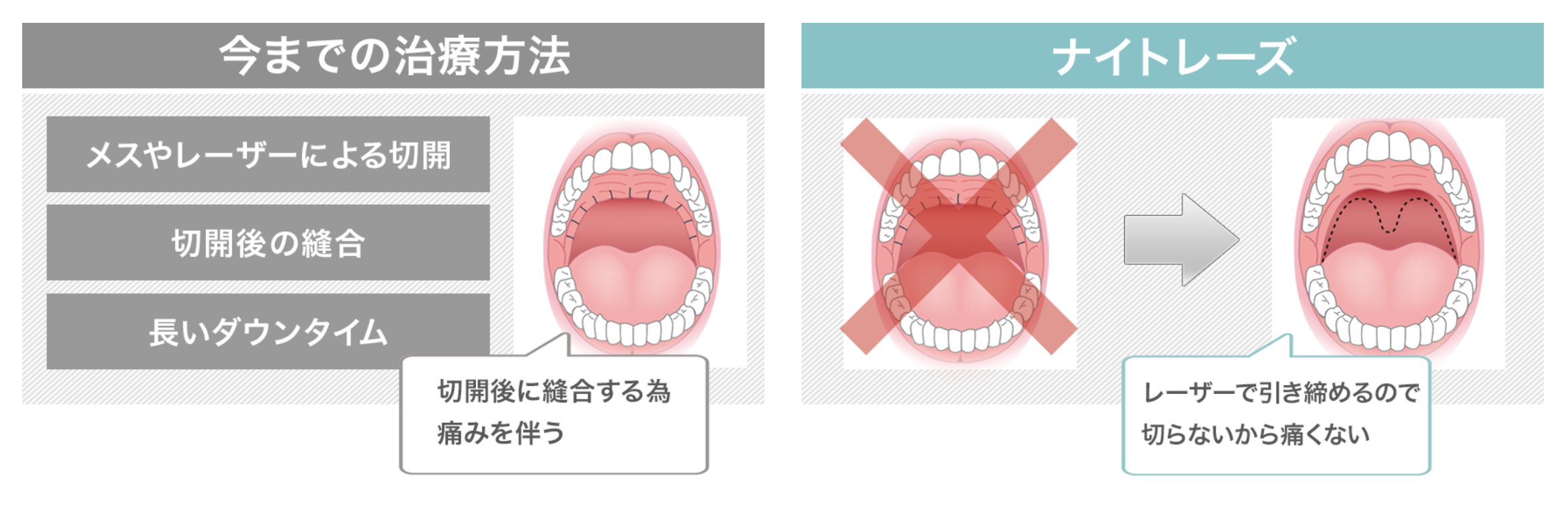 桃園打鼾止鼾打呼治療手術價格費用權威醫師推薦005