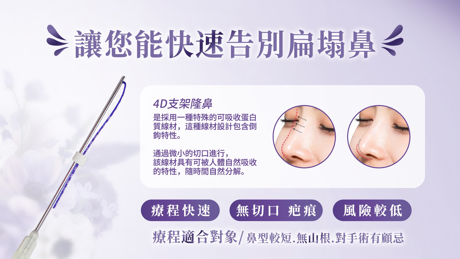 桃園埋線隆鼻權威醫師推薦價格費用003