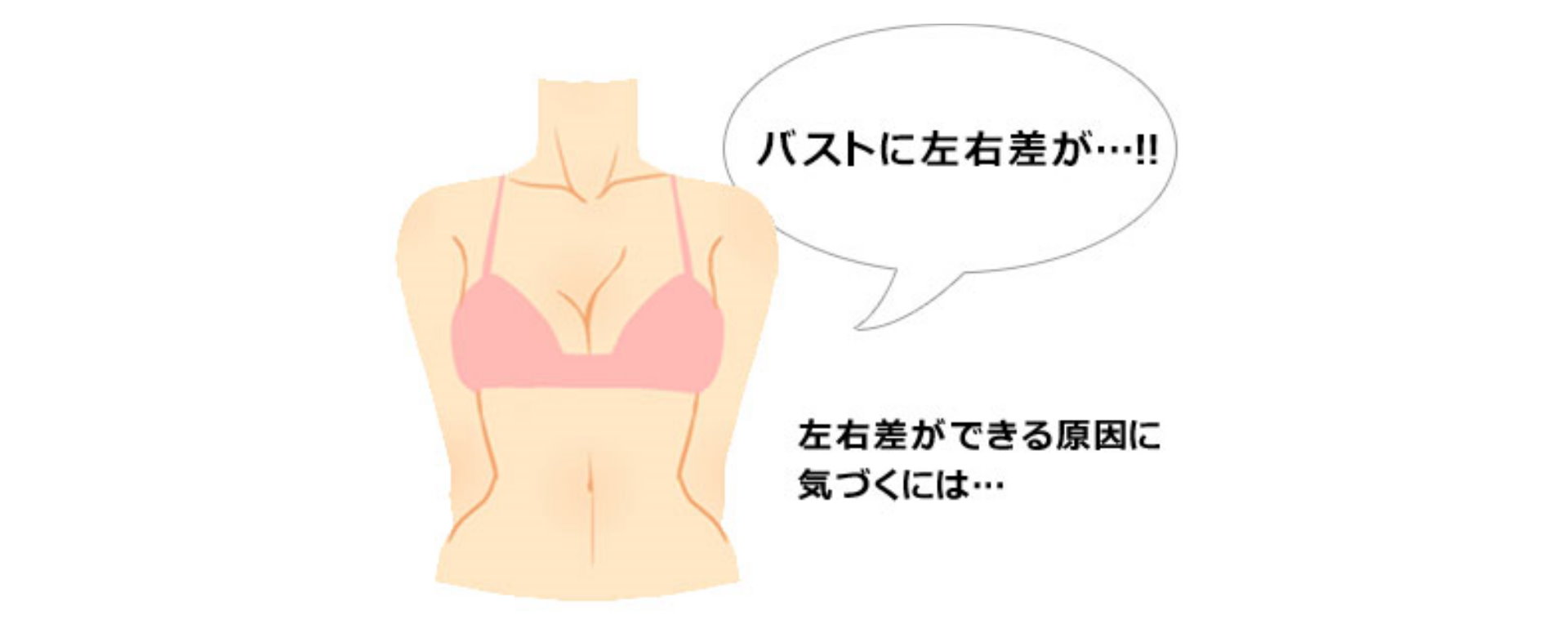 桃園隆乳失敗問題左右大小高低不對稱Dr.邱智弘醫師隆乳權威能重建