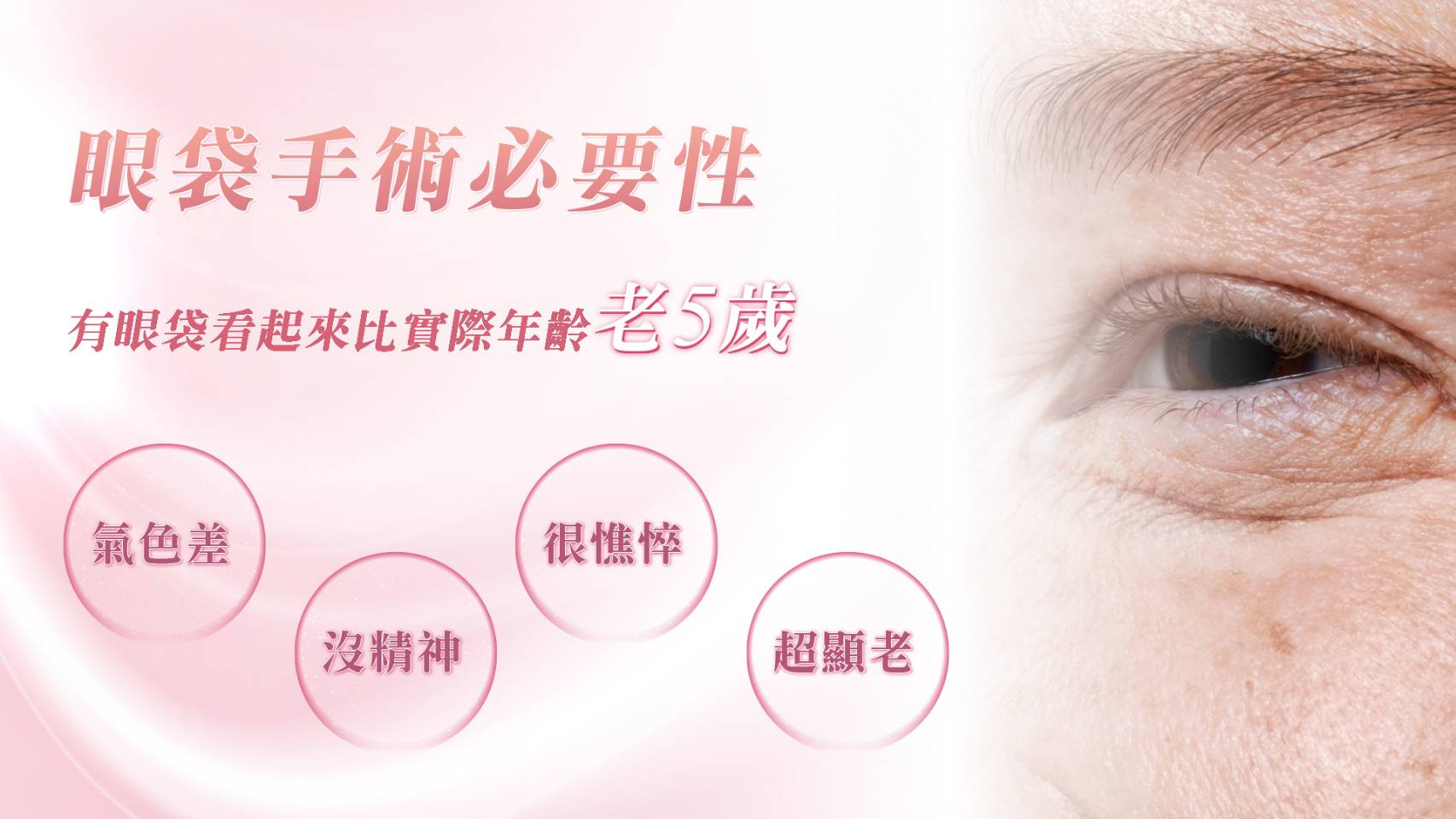 桃園眼袋手術權威醫師推薦價格價位價錢說明001