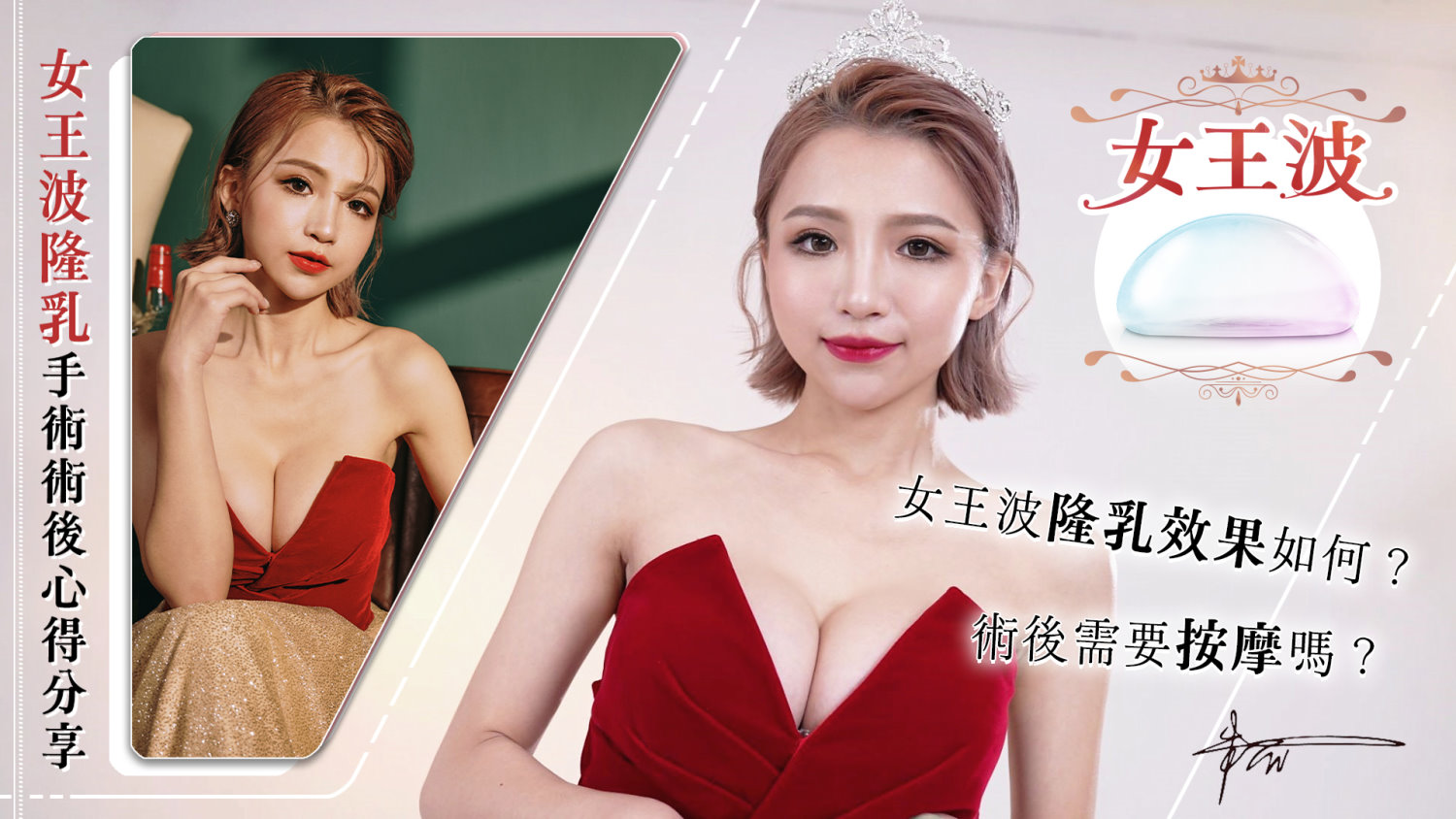女王波朱兒隆乳心得_桃園隆乳權威邱智弘醫師推薦